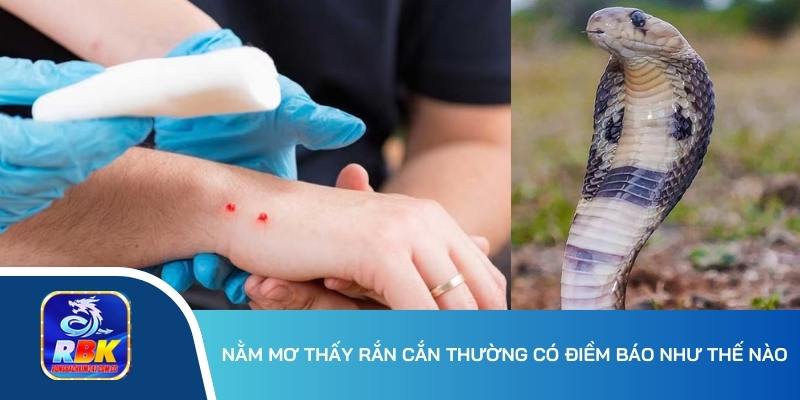 Nằm Mơ Thấy Rắn Cắn: Điềm Báo Lành Hay Dữ Cho Người Mơ?